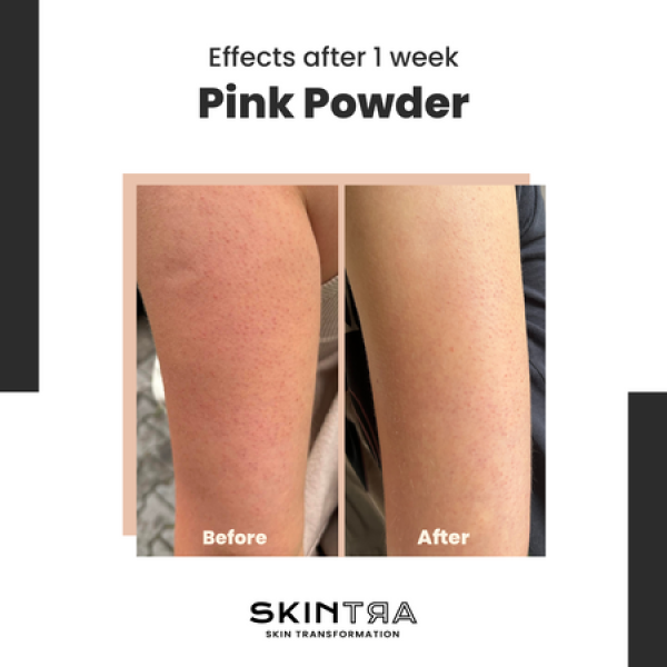 SkinTra Pink Powder Multifunctional Cleansing Enzymatic Powder on Clay Base 40g - Image 2