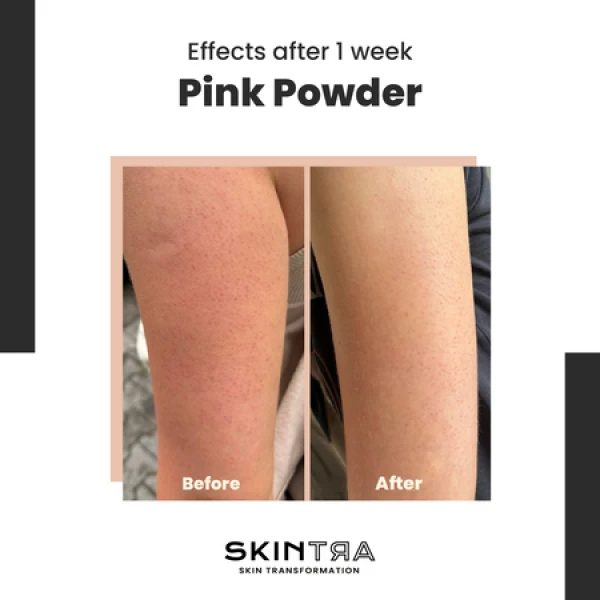 SkinTra Pink Powder Multifunctional Cleansing Enzymatic Powder on Clay Base 40g - Image 2