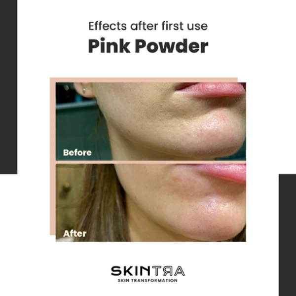 SkinTra Pink Powder Multifunctional Cleansing Enzymatic Powder on Clay Base 40g - Image 3